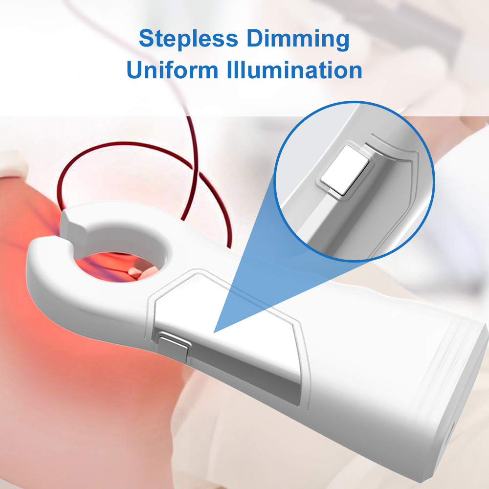 Vein Finder Portable USB Vein  - Vet Tech Accessories 评论和价格